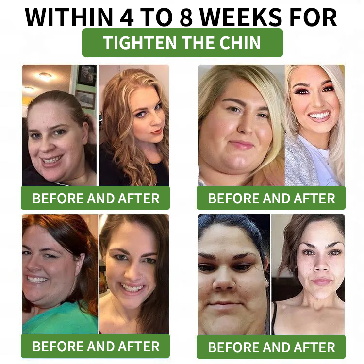 ⏳ Limited-time offer | Risarisa® BERBERINE ❤️ Nano Patch Solution A comprehensive, pain-free, and non-exhausting approach to support obesity, fatty liver, high blood pressure, inflammation, and joint pain — all in one protocol.🍃🎑🪴🌱