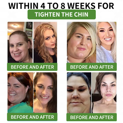 ⏳ Limited-time offer | Risarisa® BERBERINE ❤️ Nano Patch Solution A comprehensive, pain-free, and non-exhausting approach to support obesity, fatty liver, high blood pressure, inflammation, and joint pain — all in one protocol.🍃🎑🪴🌱