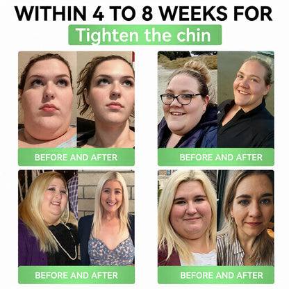 ✅RISARISA® 𝐌𝐨𝐫𝐢𝐧𝐠𝐚 × 𝐁𝐞𝐫𝐛𝐞𝐫𝐢𝐧𝐞 × 𝐀𝐌𝐏𝐊 𝟖-𝐁𝐞𝐧𝐞𝐟𝐢𝐭 𝐒𝐥𝐢𝐦𝐦𝐢𝐧𝐠 & 𝐌𝐞𝐭𝐚𝐛𝐨𝐥𝐢𝐜 𝐍𝐚𝐧𝐨 𝐌𝐢𝐜𝐫𝐨𝐧𝐞𝐞𝐝𝐥𝐞 𝐏𝐚𝐭𝐜𝐡🇺🇸(𝐉𝐮𝐬𝐭 𝐨𝐧𝐜𝐞 𝐚 𝐝𝐚𝐲, 𝐯𝐢𝐬𝐢𝐛𝐥𝐞 𝐜𝐡𝐚𝐧𝐠𝐞𝐬 𝐢𝐧 𝟕 𝐝𝐚𝐲𝐬） ✅ 𝐅𝐨𝐫 𝐨𝐛𝐞𝐬𝐢𝐭𝐲, 𝐋𝐨𝐨𝐬𝐞 𝐒𝐤𝐢𝐧,𝐝𝐢𝐚𝐛𝐞𝐭𝐞𝐬, 𝐬𝐥𝐞𝐞𝐩 𝐚𝐩𝐧𝐞𝐚, 𝐣𝐨𝐢𝐧𝐭 𝐢𝐬𝐬𝐮𝐞𝐬, 𝐚𝐧𝐝 𝐦𝐨𝐫𝐞 ⭐