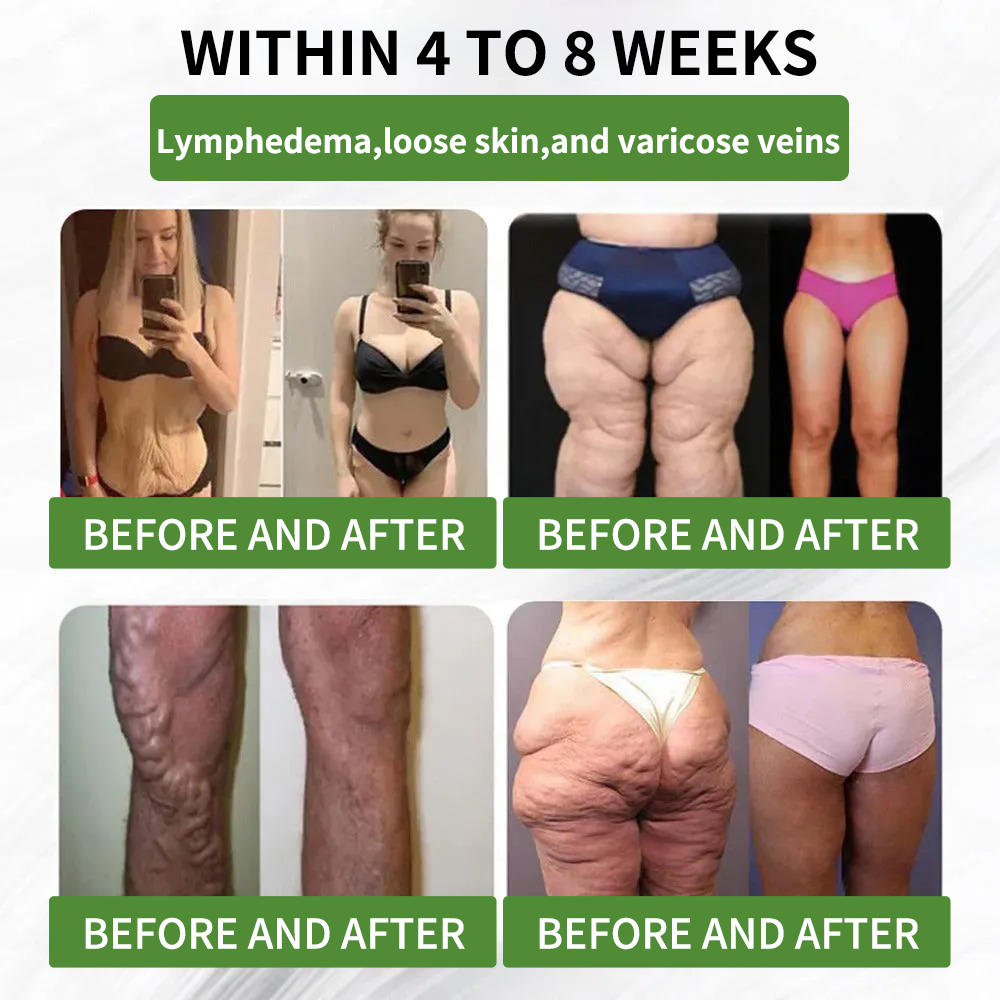 ⏳ Limited-time offer | Risarisa® BERBERINE ❤️ Nano Patch Solution A comprehensive, pain-free, and non-exhausting approach to support obesity, fatty liver, high blood pressure, inflammation, and joint pain — all in one protocol.🍃🎑🪴🌱