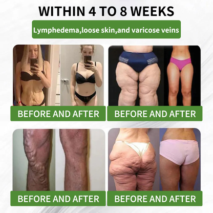 ⏳ Limited-time offer | Risarisa® BERBERINE ❤️ Nano Patch Solution A comprehensive, pain-free, and non-exhausting approach to support obesity, fatty liver, high blood pressure, inflammation, and joint pain — all in one protocol.🍃🎑🪴🌱