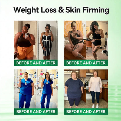 ✅RISARISA® 𝐌𝐨𝐫𝐢𝐧𝐠𝐚 × 𝐁𝐞𝐫𝐛𝐞𝐫𝐢𝐧𝐞 × 𝐀𝐌𝐏𝐊 𝟖-𝐁𝐞𝐧𝐞𝐟𝐢𝐭 𝐒𝐥𝐢𝐦𝐦𝐢𝐧𝐠 & 𝐌𝐞𝐭𝐚𝐛𝐨𝐥𝐢𝐜 𝐍𝐚𝐧𝐨 𝐌𝐢𝐜𝐫𝐨𝐧𝐞𝐞𝐝𝐥𝐞 𝐏𝐚𝐭𝐜𝐡🇺🇸(𝐉𝐮𝐬𝐭 𝐨𝐧𝐜𝐞 𝐚 𝐝𝐚𝐲, 𝐯𝐢𝐬𝐢𝐛𝐥𝐞 𝐜𝐡𝐚𝐧𝐠𝐞𝐬 𝐢𝐧 𝟕 𝐝𝐚𝐲𝐬） ✅ 𝐅𝐨𝐫 𝐨𝐛𝐞𝐬𝐢𝐭𝐲, 𝐋𝐨𝐨𝐬𝐞 𝐒𝐤𝐢𝐧,𝐝𝐢𝐚𝐛𝐞𝐭𝐞𝐬, 𝐬𝐥𝐞𝐞𝐩 𝐚𝐩𝐧𝐞𝐚, 𝐣𝐨𝐢𝐧𝐭 𝐢𝐬𝐬𝐮𝐞𝐬, 𝐚𝐧𝐝 𝐦𝐨𝐫𝐞 ⭐