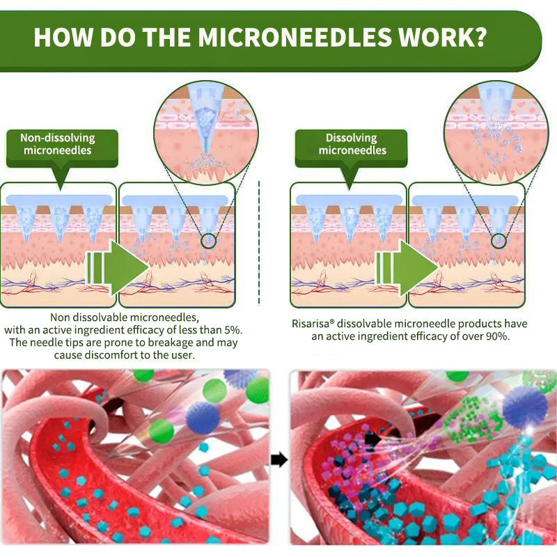⏳ Limited-time offer | Risarisa® BERBERINE ❤️ Nano Patch Solution A comprehensive, pain-free, and non-exhausting approach to support obesity, fatty liver, high blood pressure, inflammation, and joint pain — all in one protocol.🍃🎑🪴🌱
